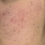 혐주의)와 나 <b>모공</b>봐