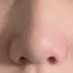 너희 이런 <b>복코</b>면 코성형 할거같늠?ㅠ