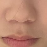 [댓글부탁해] 복코땜에 넘 스트레스야..ㅜㅜ