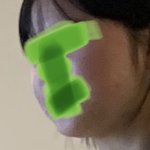 이번 달에 얼굴지흡 할거임 ㅜ