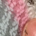 [댓글부탁해] 손톱에 검은 <b>반점</b>이 나는데 뭔가요..