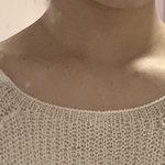 [댓글부탁해] 승모근 심하면 이런옷 <b>에바</b>지?..