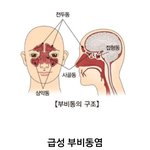 같고 편두통이 오지며 갑자기 치통이 생긴다면 바로 '<b>이</b> <b>병</b>'이다