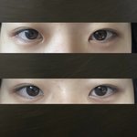 [댓글부탁해] <b>이</b> <b>눈</b> 어케 해야댈까??