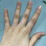 [댓글부탁해] 나 <b>단풍손</b> 심함??ㅠ