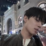 쌍수 성공한듯!! 전후 보여줄게