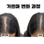 [댓글부탁해] 얘들아 나 <b>탈모</b>같음??