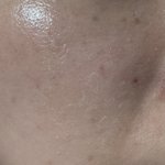 기초화장 후 베이스 화장시 각질<b>부각</b>ㅠㅠ(사진ㅇ)