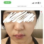 톡선 중국인 틱톡커처럼 다이어트 <b>전후</b>차이나려면