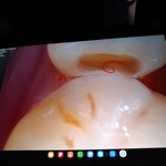 [어떻게생각] 치과에서 치료받는데 서로 <b>잡담</b>하신다면..