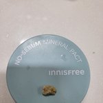 내 <b>대왕</b> 편도결석 볼 사람 (혐주의