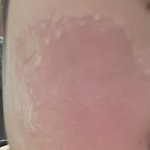 [댓글부탁해] 나 <b>홍조</b> 개심한데