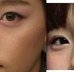 [댓글부탁해] 태연 <b>성형들</b> 보다가 궁금한건데 이거 ㄹㅇ임?