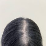 [이것좀봐줘] 26살 <b>두피</b>문신 후기