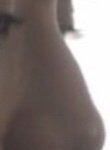 너네 이런코였으면 성형함?