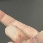 물건던지다가 베여서 손에피남