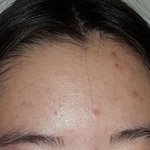 나 <b>헤어</b>라인 더러워?