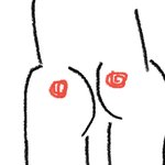 [드루와] 나 응뎅이에 개웃긴 <b>흉터</b> 있음