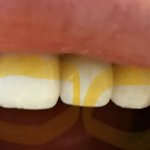 혐짤주의)유명김밥 체인점에서 이거 나왔는데 제가 예민한건지 <b>문의</b>답변부탁