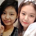 [댓글부탁해] 제니도 성형한거 아냐?