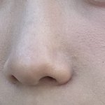 혐주의) 이런 피부<b>요철</b> 어케 좋아져?