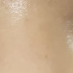 다들 쌍수 <b>흉터</b> 언제없어졌어??