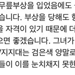 뉴진스 하니 <b>무릎부상</b> 입었었대