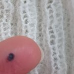 얘<b>두라</b> 살 찝히는거 조심해....