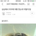 너네 이마가 이러면 <b>외출</b>가능?