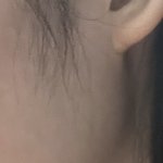 나 <b>귀밑</b>턱 심한거임?
