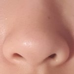 코 못 나서 슬프다~