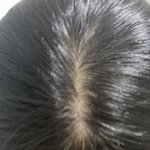 [댓글부탁해] 아니얘들아 나 <b>탈모</b>인가