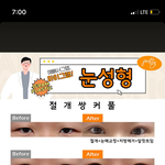 와 눈성형이거 <b>보정</b>아니냐?