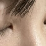 [댓글부탁해] 앞트임 괜히했다 진짜 ㅠ