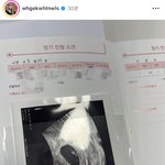 [댓글부탁해] <b>조두</b>팔 둘째 임신했네