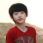 이런경우는 앞트임한거임?