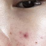 피부 심한편임?ㅠ