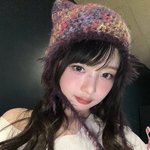 레이 요즘 <b>리즈</b>