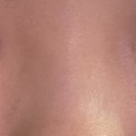 [댓글부탁해] <b>복코</b> 속상하다 진짜…쉐딩도 하긴하는데 어렵다