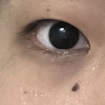 [댓글부탁해] 이거 안검<b>하수</b>야??