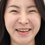 이사람 <b>치아</b>에 이거 뭐임???