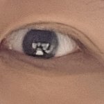 눈 <b>밑</b>에 이거 뭐야?