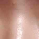 나 쌍수 <b>티남</b>?