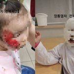 깡통열차 전복 미성년 <b>여아</b> 2명등 세모녀 큰부상