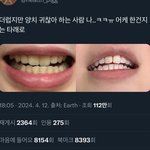 [모두드루와] 트위터에서 화제 중인 치아 <b>미백</b> 짤