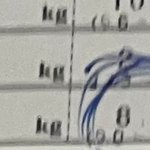 내 성형일대기 +질문 받아줌