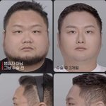 유튜버 <b>렉카</b> 구제역 성형 전후