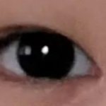 나 앞트임한지 3개월만에 붙었는데이거맞음?ㅋ..