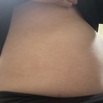 고<b>1</b> <b>1</b>년동안 살이 19kg 쪘어 ㅠㅠ 이정도면 얼마나 심한거야