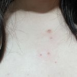 [댓글부탁해] <b>쇄골</b>이랑 어깨 쪽에 갑자기